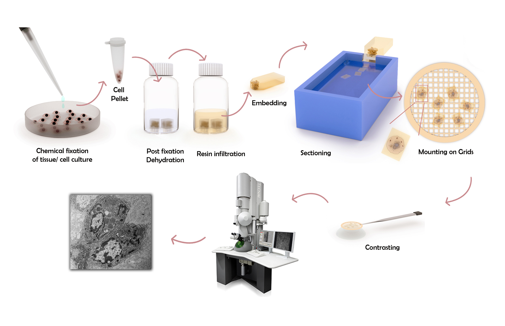 electron-microscopy-conventional-chemical-fixation-chemical